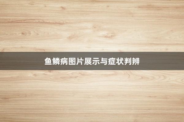 鱼鳞病图片展示与症状判辨